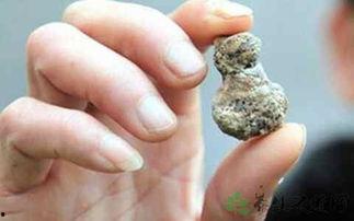 肾结石吃毛瓜,毛瓜助力健康排石新选择